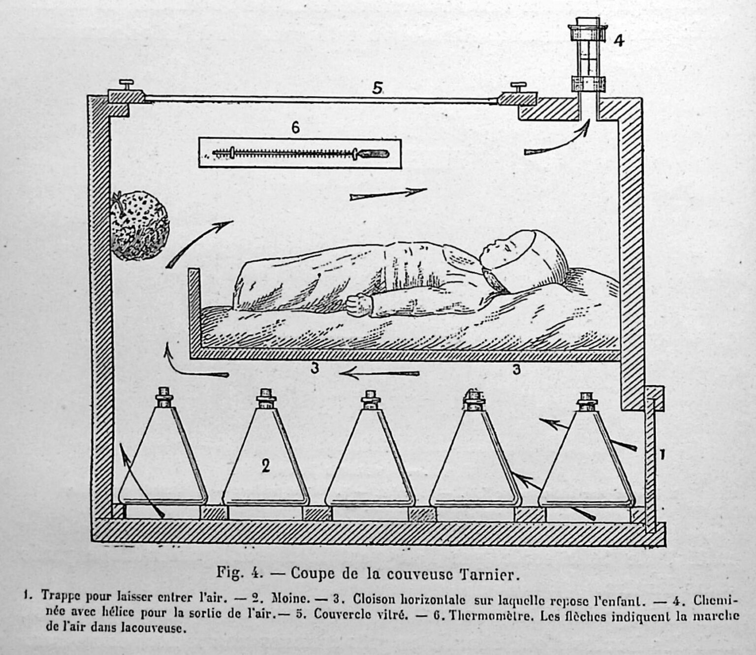 Incubators Through the Years – Neonatology on the Web