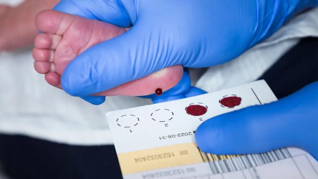 Newborn Screening – Neonatology on the Web